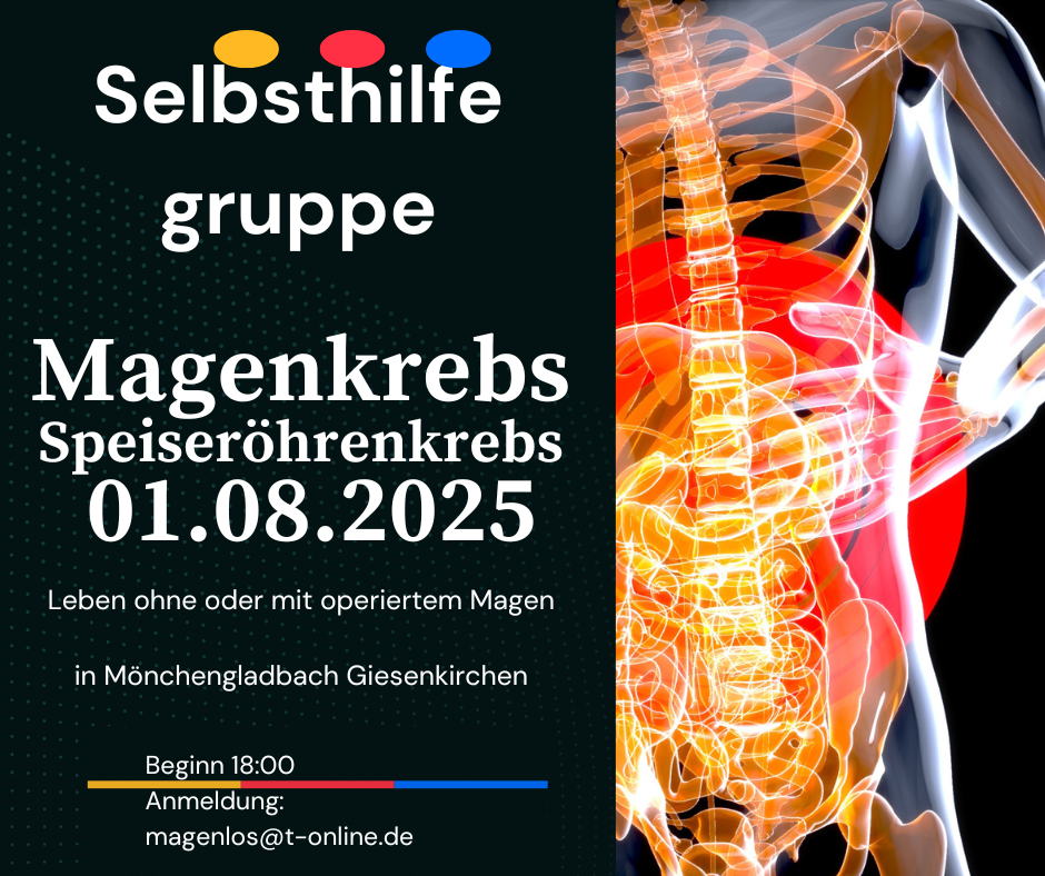 Magenkrebs Selbsthilfegruppe
